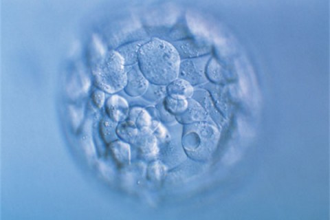 http://changsha.quanwangkm.com/post/190.html|长沙人工试管